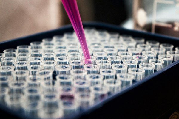 Understanding Water Testing Parameters: A Plain Guide